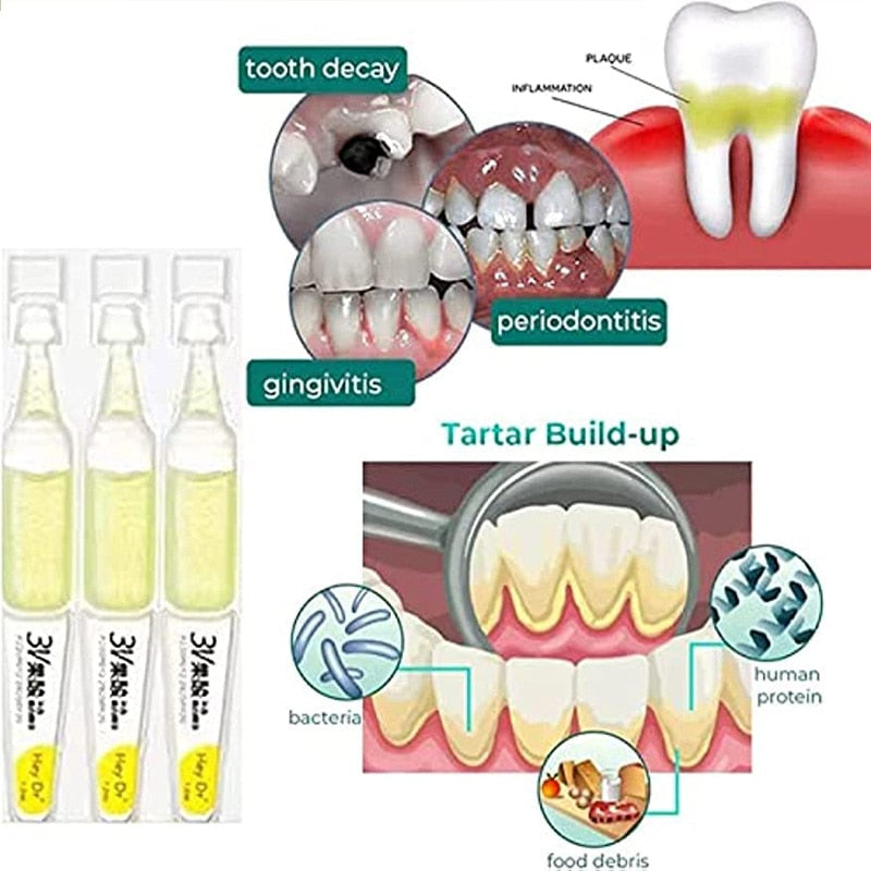 BRILL TLOPA™ (Tartar Plaque Bacteria And Various Oral Problems Remover Teeth Whitening Serum)