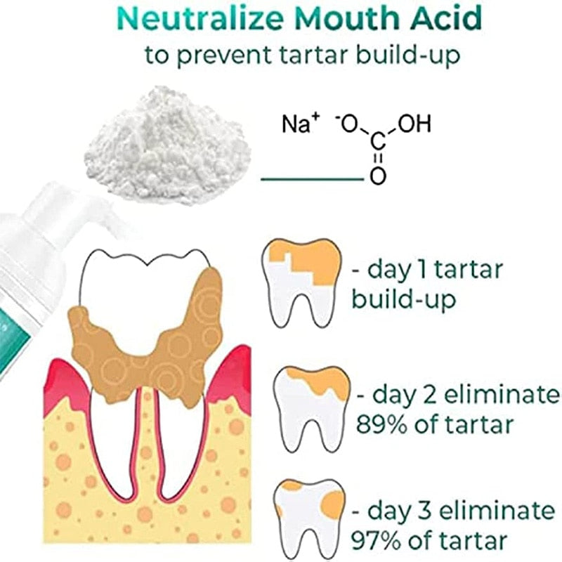 BRILL TLOPA™ (Tartar Plaque Bacteria And Various Oral Problems Remover Teeth Whitening Serum)