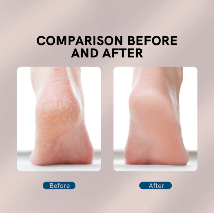 Brill™ Flawless File and Callus Remover